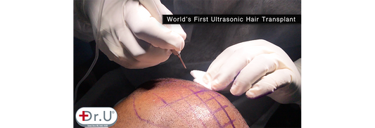 ugraft sonic fue by dr u