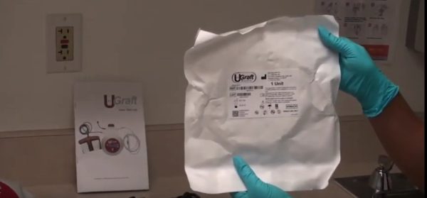 The Dr.UGraft tubing system connects the fluid bag to the console, establishing the fluid component of the overall hair transplant punch system